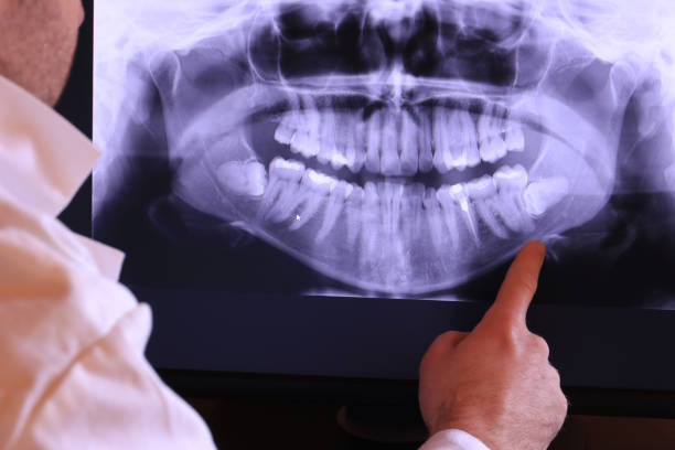 Best Emergency Dental Care for Broken or Chipped Teeth in Deland, FL